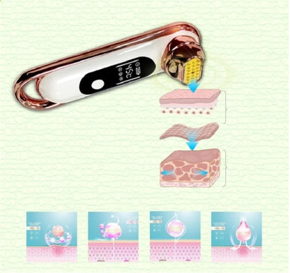 Alevra RF Beauty Device for Firming, Whitening, and Skin Care